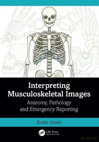 Interpreting Musculoskeletal Images - Rosie Jones [KSIĄŻKA]