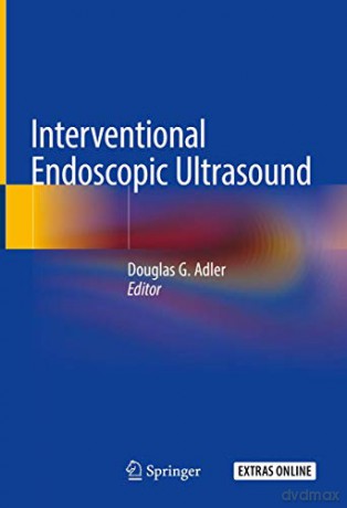 Interventional Endoscopic Ultrasound - Adler Douglas G. [KSIĄŻKA]