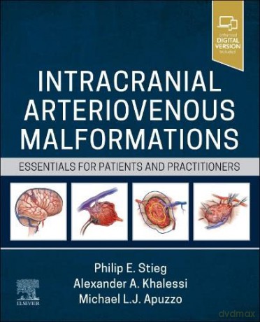 Intracranial Arteriovenous Malformations - Philip E. Stieg [KSIĄŻKA]