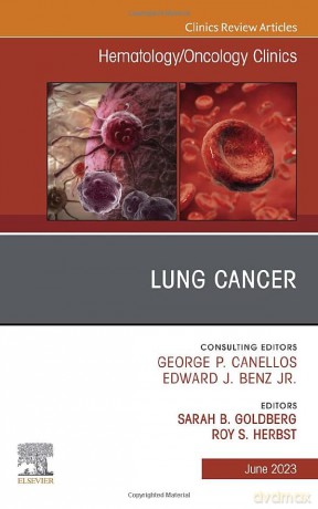 Lung Cancer An Issue Of Hematologyoncolo - Sarah B. Goldberg [KSIĄŻKA]