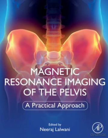 Magnetic Resonance Imaging Of The Pelvis - Neeraj Lalwani [KSIĄŻKA]