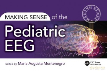 Making Sense Of The Pediatric Eeg - Maria Montenegro [KSIĄŻKA]