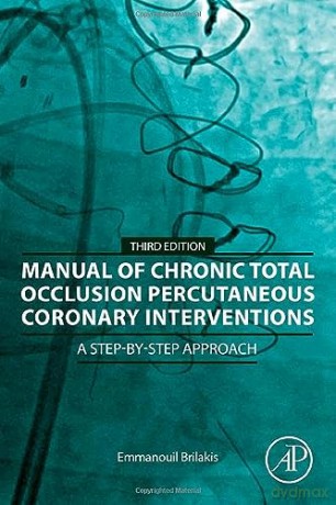 Manual Of Chronic Total Occlusion Percut - Emmanouil Brilakis [KSIĄŻKA]