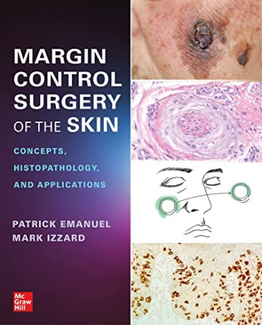 Margin Control Surgery Of The Skin Con [KSIĄŻKA]