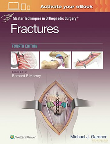 Master Techniques In Orthopaedic Surgery - Gardner [KSIĄŻKA]