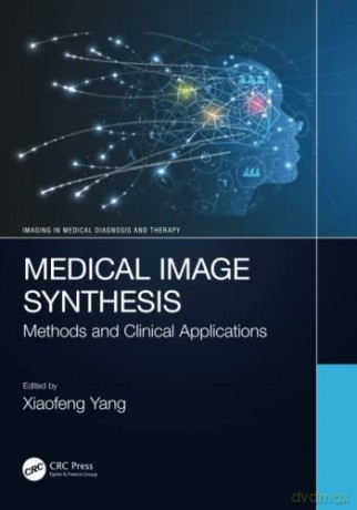 Medical Image Synthesis - Xiaofeng Yang [KSIĄŻKA]