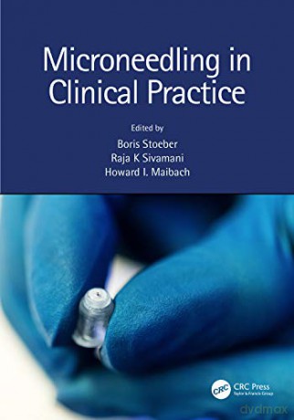 Microneedling In Clinical Practice - Stoeber Boris [KSIĄŻKA]