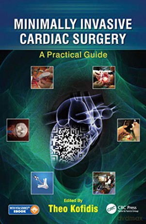 Minimally Invasive Cardiac Surgery - Theodoros Kofidis [KSIĄŻKA]