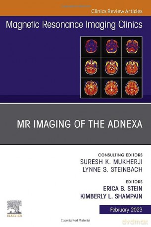 Mr Imaging Of The Adnexa An Issue Of Mag - Erica B. Stein [KSIĄŻKA]