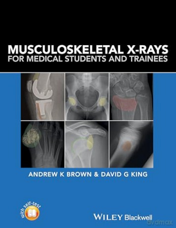 Musculoskeletal Xrays For Medical Studen - Andrew K. Brown [KSIĄŻKA]
