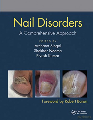 Nail Disorders - Archana Singal [KSIĄŻKA]