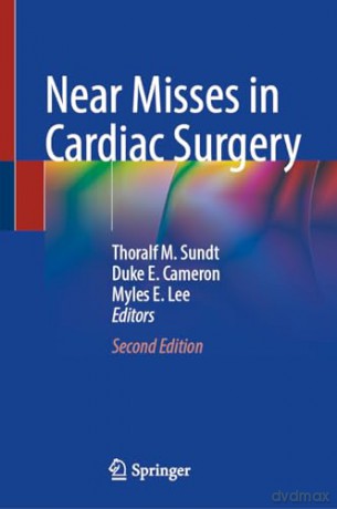 Near Misses In Cardiac Surgery - Sundt [KSIĄŻKA]