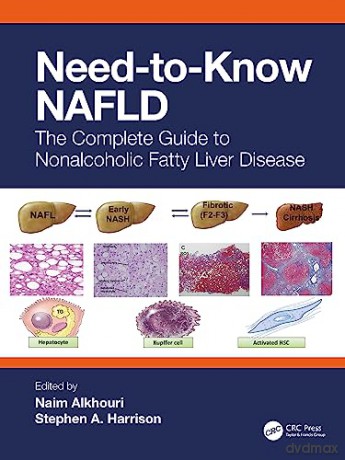 Needtoknow Nafld - Naim Alkhouri [KSIĄŻKA]