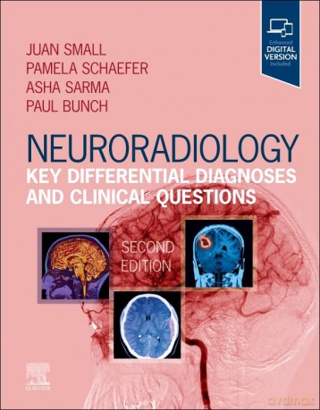 Neuroradiology Key Differential Diagnose - Juan E. Small [KSIĄŻKA]