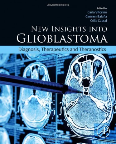 New Insights Into Glioblastoma - Carla Vitorino [KSIĄŻKA]