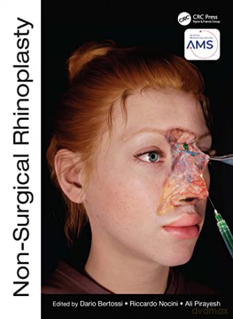 Nonsurgical Rhinoplasty - Dario Bertossi [KSIĄŻKA]
