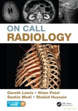 On Call Radiology - Gareth Lewis [KSIĄŻKA]