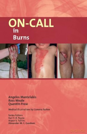 Oncall In Burns - Angelos Mantelakis [KSIĄŻKA]