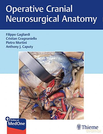 Operative Cranial Neurosurgical Anatomy - Filippo Gagliardi [KSIĄŻKA]