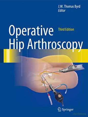 Operative Hip Arthroscopy - J.W. Thomas Byrd [KSIĄŻKA]