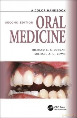 Oral Medicine Second Edition - Michael Lewis [KSIĄŻKA]