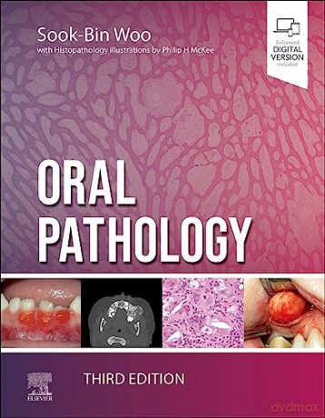 Oral Pathology - Sook-Bin Woo [KSIĄŻKA]