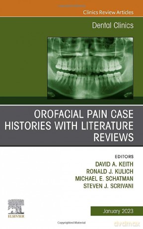 Orofacial Pain Case Histories With Liter - David A. Keith [KSIĄŻKA]