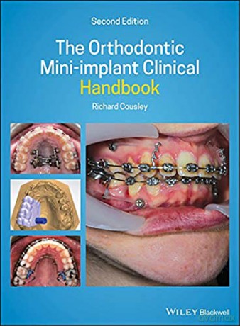 Orthodontic Miniimplant Clinical Handboo - Richard Cousley [KSIĄŻKA]