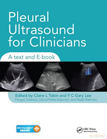 Pleural Ultrasound For Clinicians - Claire Tobin [KSIĄŻKA]