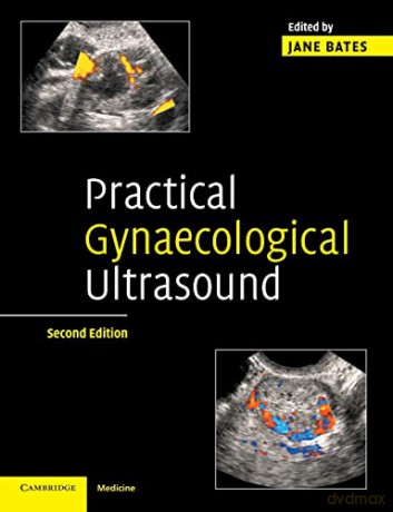 Practical Gynaecological Ultrasound - Jane(Ed) Bates [KSIĄŻKA]