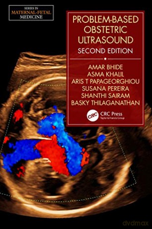 Problembased Obstetric Ultrasound Second - Amar Bhide [KSIĄŻKA]