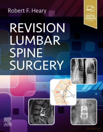 Revision Lumbar Spine Surgery - Robert F. Heary [KSIĄŻKA]