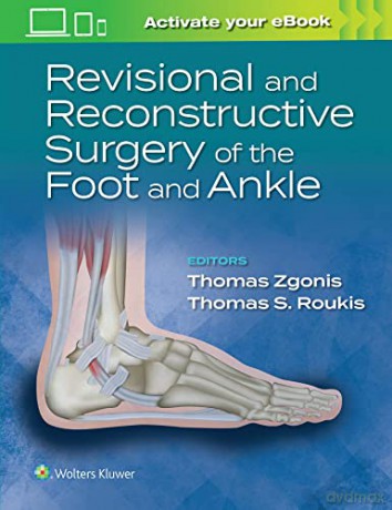 Revisional Recon Surgery Foot Ankle [KSIĄŻKA]