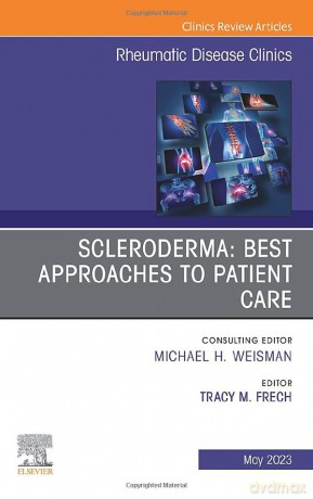 Scleroderma Best Approaches To Patient C - Tracy M. Frech [KSIĄŻKA]