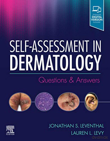 Selfassessment In Dermatology Questions - Jonathan Leventhal [KSIĄŻKA]