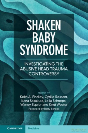 Shaken Baby Syndrome - Keith A. Findley [KSIĄŻKA]