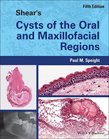 Shears Cysts Of The Oral And Max [KSIĄŻKA]