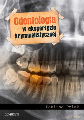 Odontologia W Ekspertyzie Kryminalistycznej - Polak P. [KSIĄŻKA]