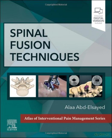 Spinal Fusion Techniques - Alaa Abd-Elsayed [KSIĄŻKA]
