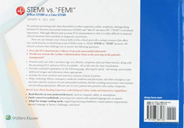 Stemi Vs Femi Real Deal Or Fake Stemi [KSIĄŻKA]