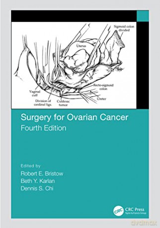 Surgery For Ovarian Cancer - Robert Bristow [KSIĄŻKA]