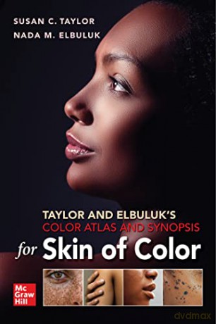 Taylor And Elbuluks Color Atlas And Sy [KSIĄŻKA]
