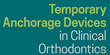 Temporary Anchorage Devices In Clinical - Jae Hyun Park [KSIĄŻKA]