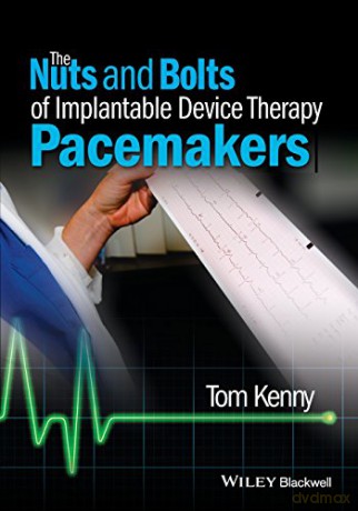 The Nuts And Bolts Of Implantable Devic [KSIĄŻKA]