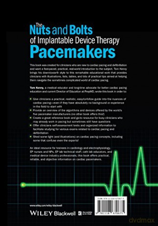 The Nuts And Bolts Of Implantable Devic [KSIĄŻKA]