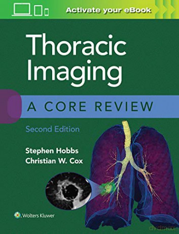 Thoracic Imaging A Core Review 2e - Hobbs Stephen [KSIĄŻKA]