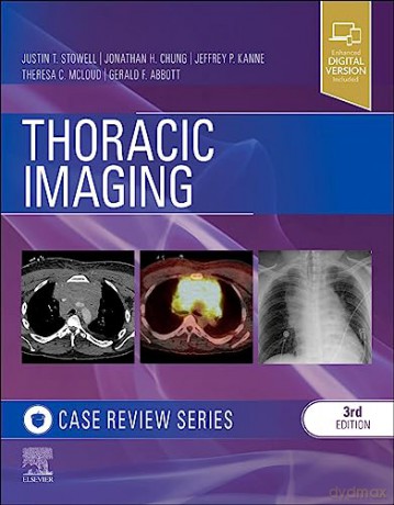 Thoracic Imaging Case Review - Gerald F. Abbott [KSIĄŻKA]