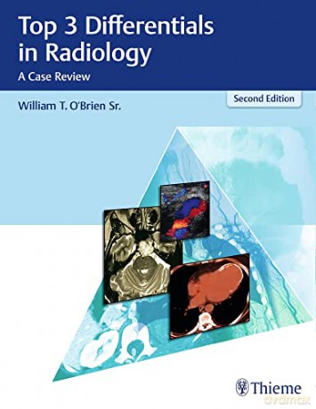 Top 3 Differentials In Radiology - William T. O'brien [KSIĄŻKA]