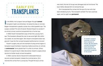 Transplant Breakthroughs - Heather E Schwartz [KSIĄŻKA]
