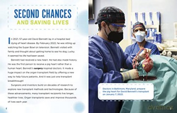 Transplant Breakthroughs - Heather E Schwartz [KSIĄŻKA]